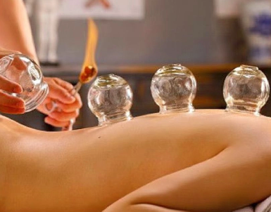 Cupping therapy session